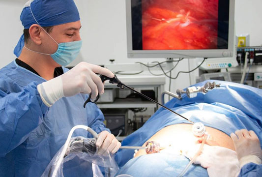 Laparoscopic Mini Gastric Bypass
