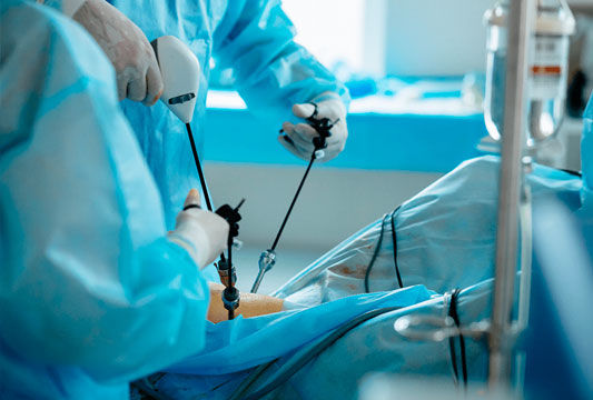 Laparoscopic Sleeve Gastrectomy