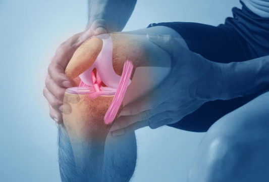 ACL Injury