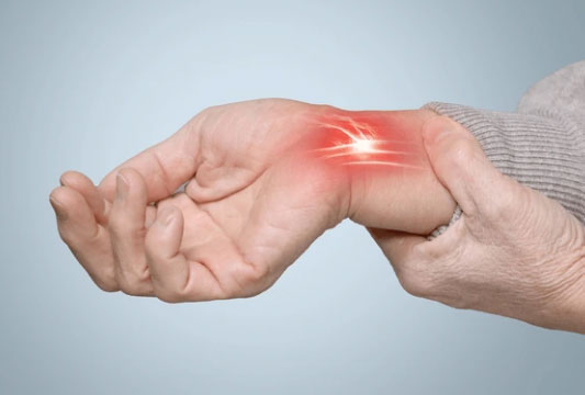 Carpal Tunnel Syndrome
