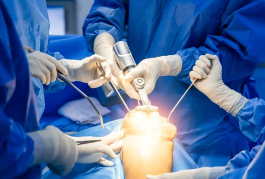 Knee Replacement Surgery
