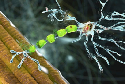 Neuromuscular Disorders/Diseases
